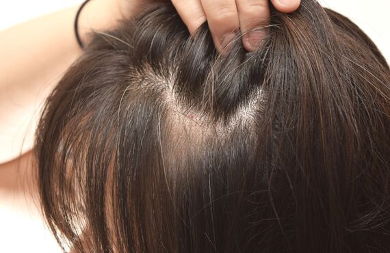 ダメージレスな方法で頭皮の乾燥を防ぐ | 髪質ケアにこだわる仙台から近い美容室・it hair